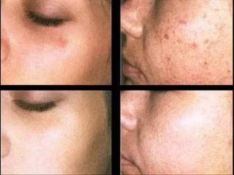 FIRMING VENZEN SUERO REAFIRMANTE ANTIEDAD